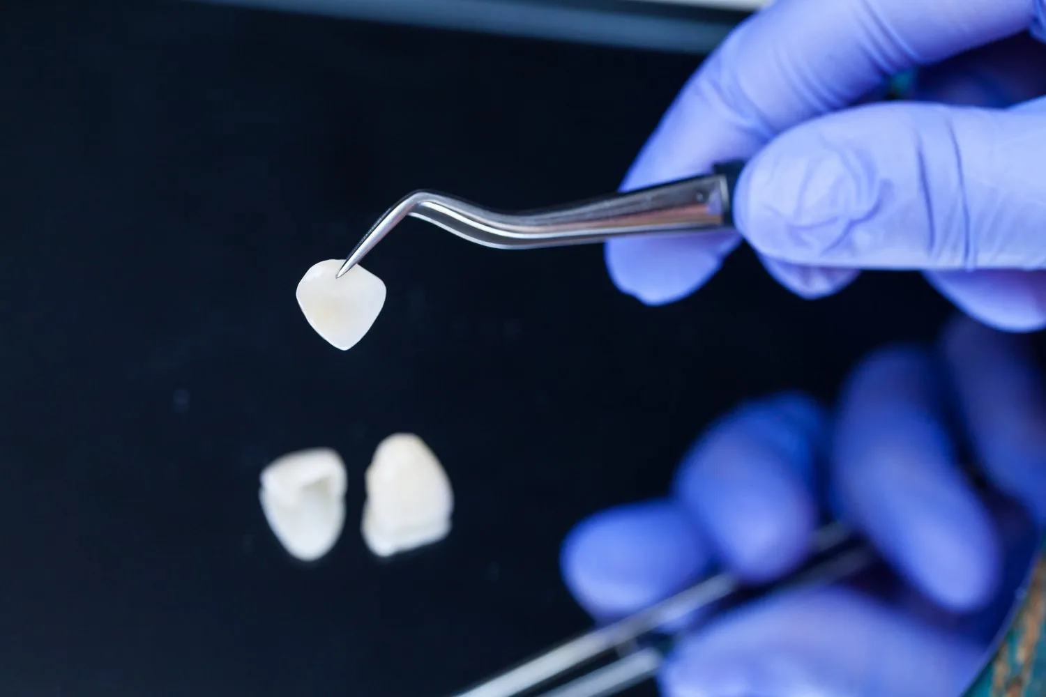 Gloved hand holding a dental veneer with tweezers above two other veneers on a dark surface.
